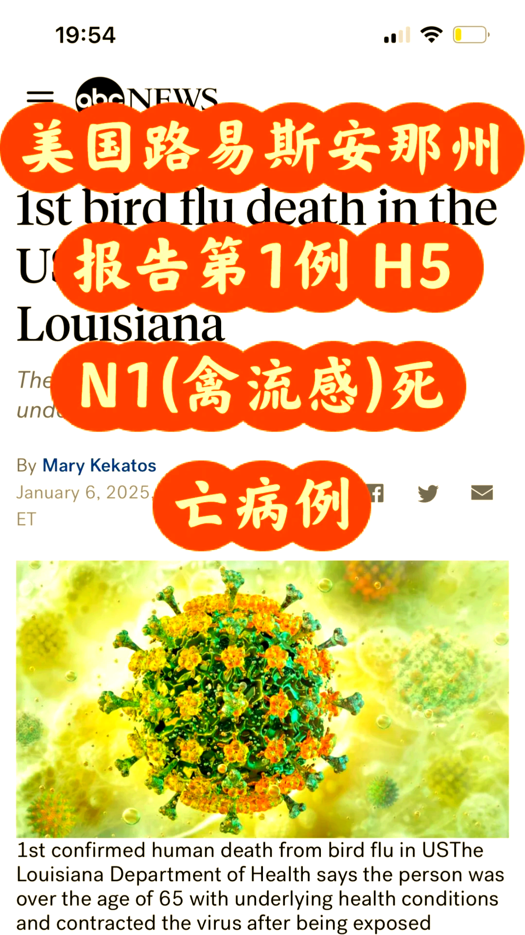 美国新冠肺炎确诊近200万例︰(美国新冠肺炎累计确诊超2370万例)-第3张图片