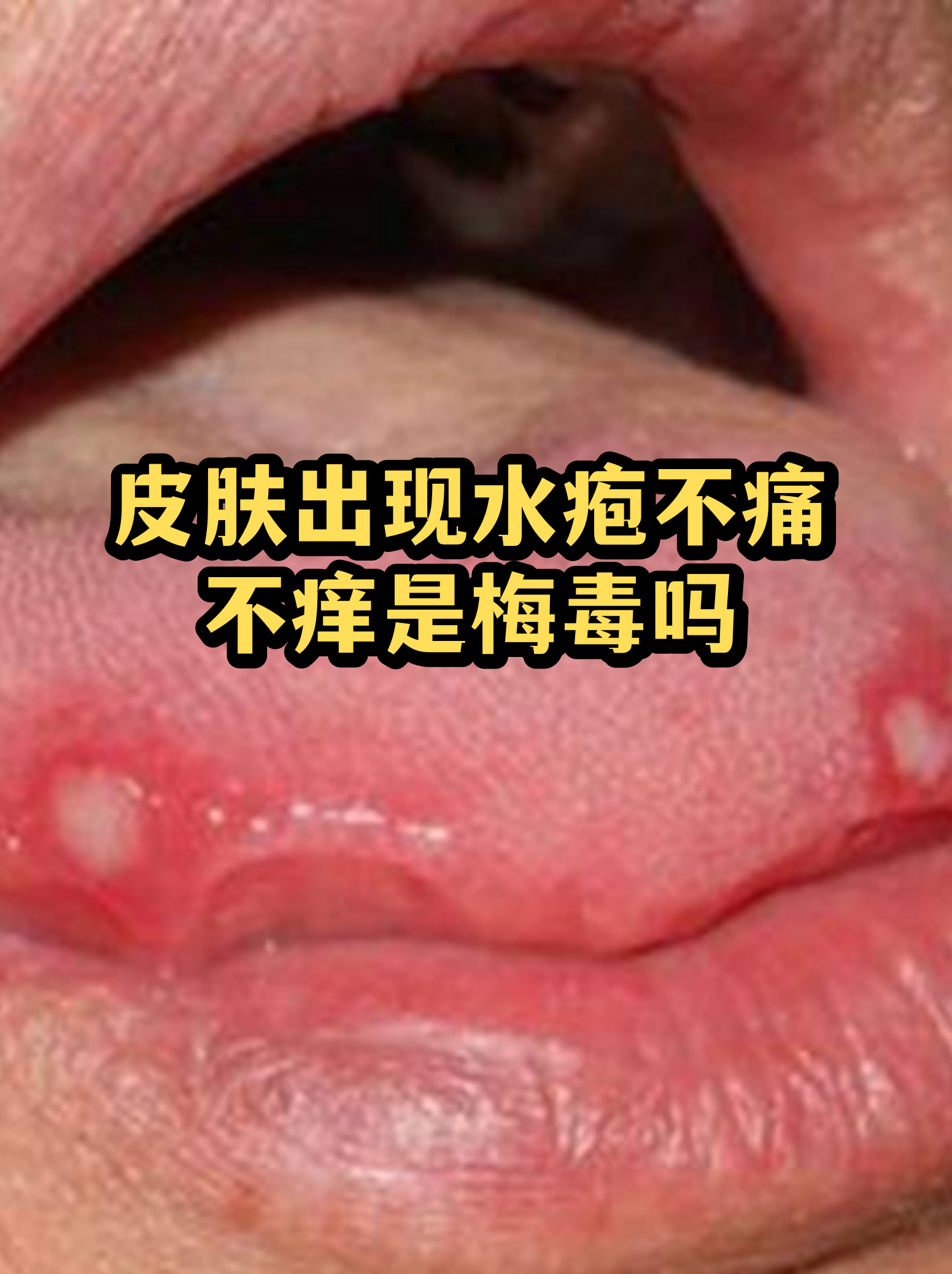 “保定:感染者确实不少” 保定感染病例？-第2张图片