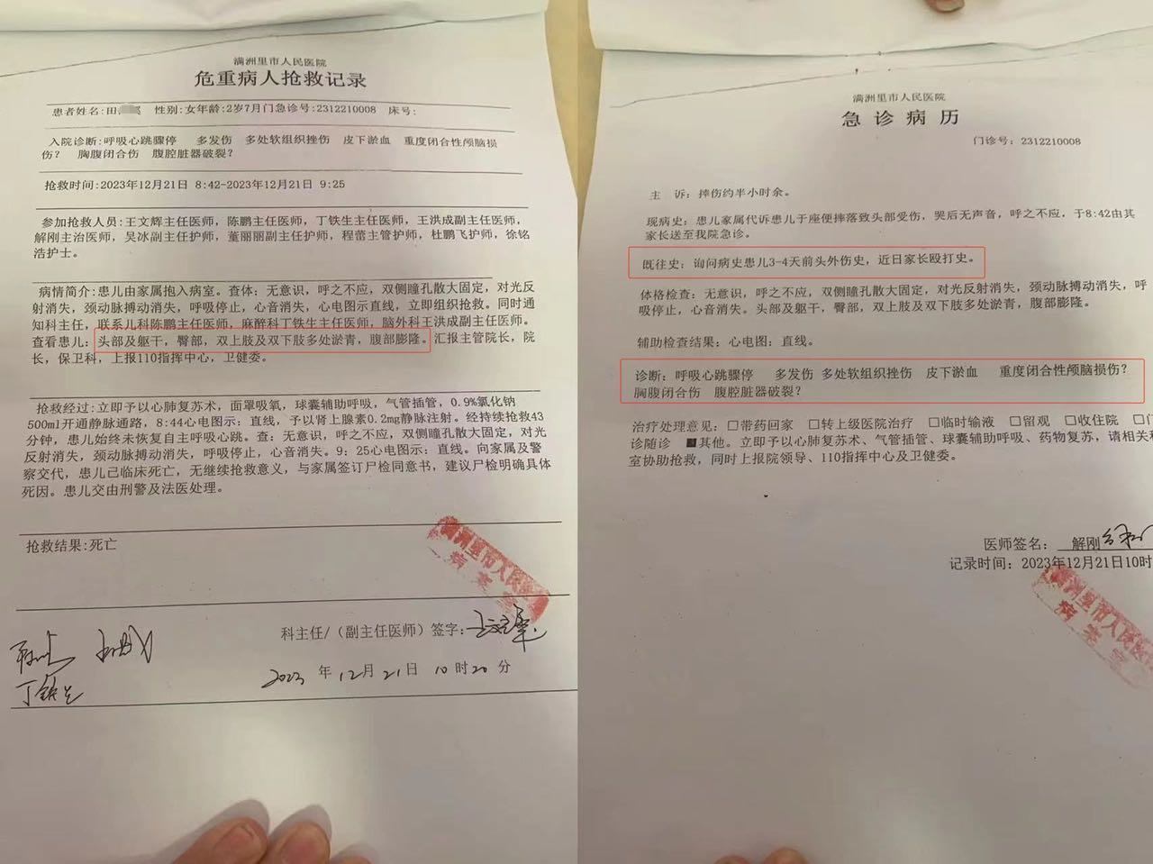 “云南本土病例	” 云南本土病例3例？-第2张图片