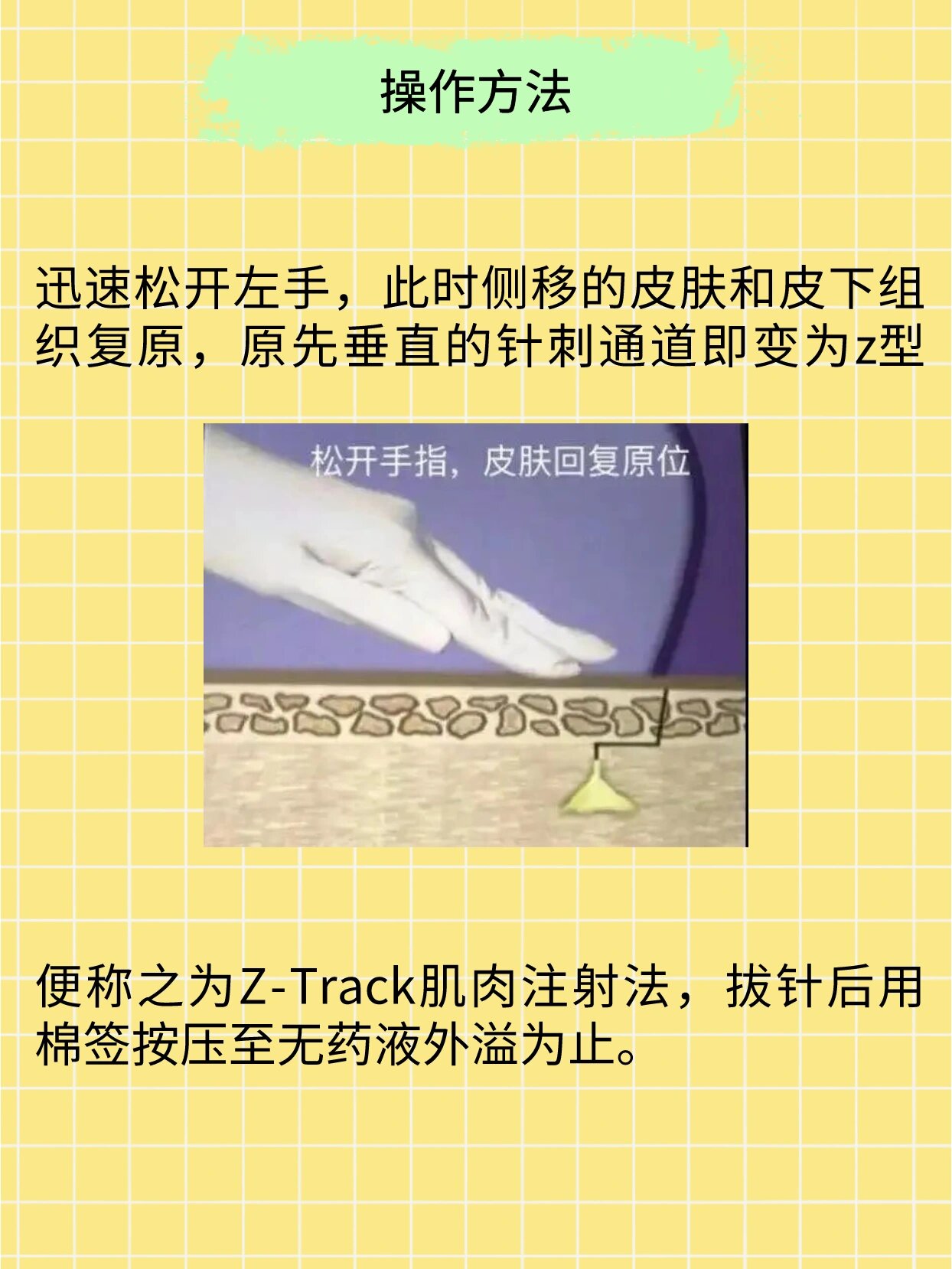 3分钟学会“人皇大厅透视挂”开挂(透视)辅助教程-第2张图片