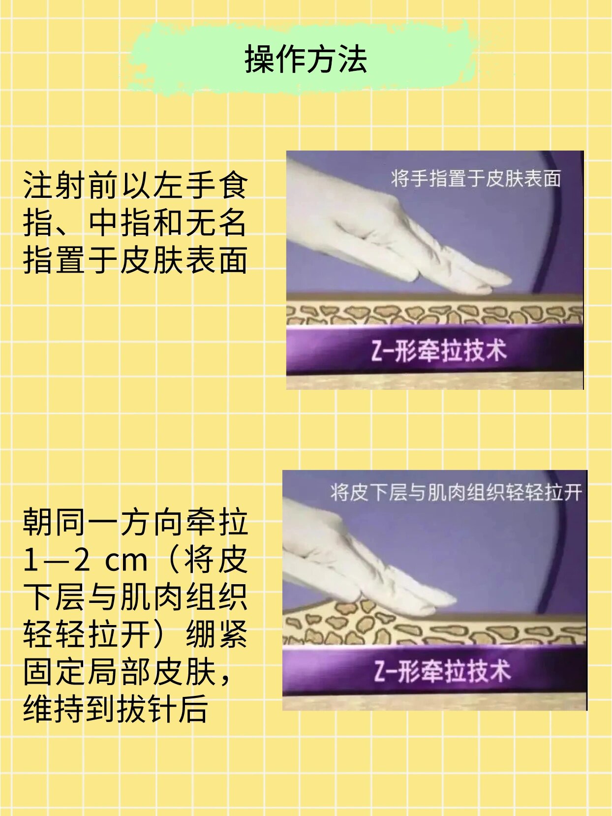 3分钟学会“闲逸碰胡可以开挂吗”分享装挂详细步骤-第1张图片