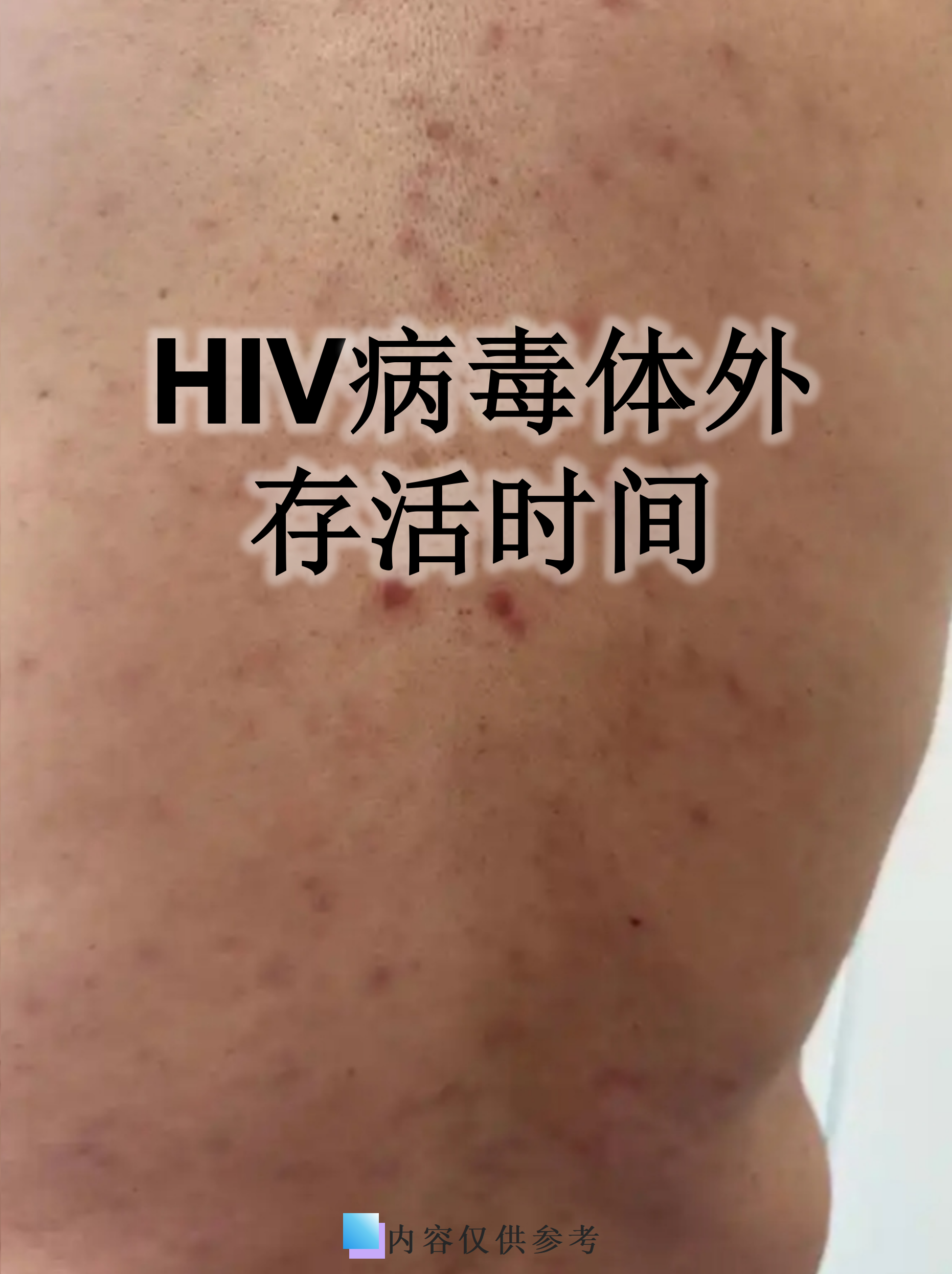 德尔塔毒株发病很快〃德尔塔毒株发病很快症状-第1张图片